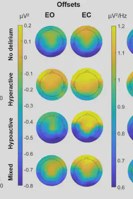 EEG topographic maps of spectral offsets across delirium subtypes (no delirium, hyperactive, hypoactive and mixed), for eyes-open (EO) and eyes-closed (EC) recordings