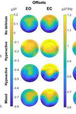 Delirium VULnerability in GEriatrics (DIVULGE) 2 Study